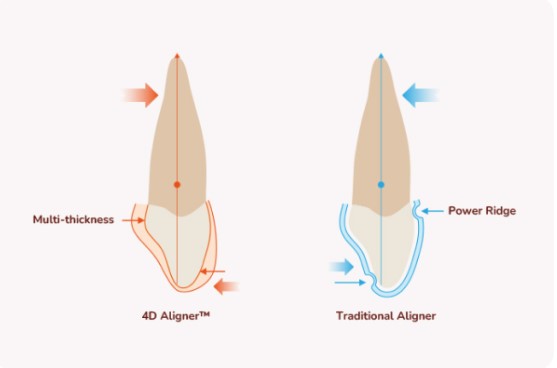 מדפסת iLux Pro Dental