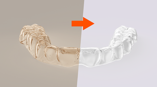 המחשה של קשתית 4D Aligner™ בגוון צהבהב לצד קשתית שקופה לאחר ניקוי.