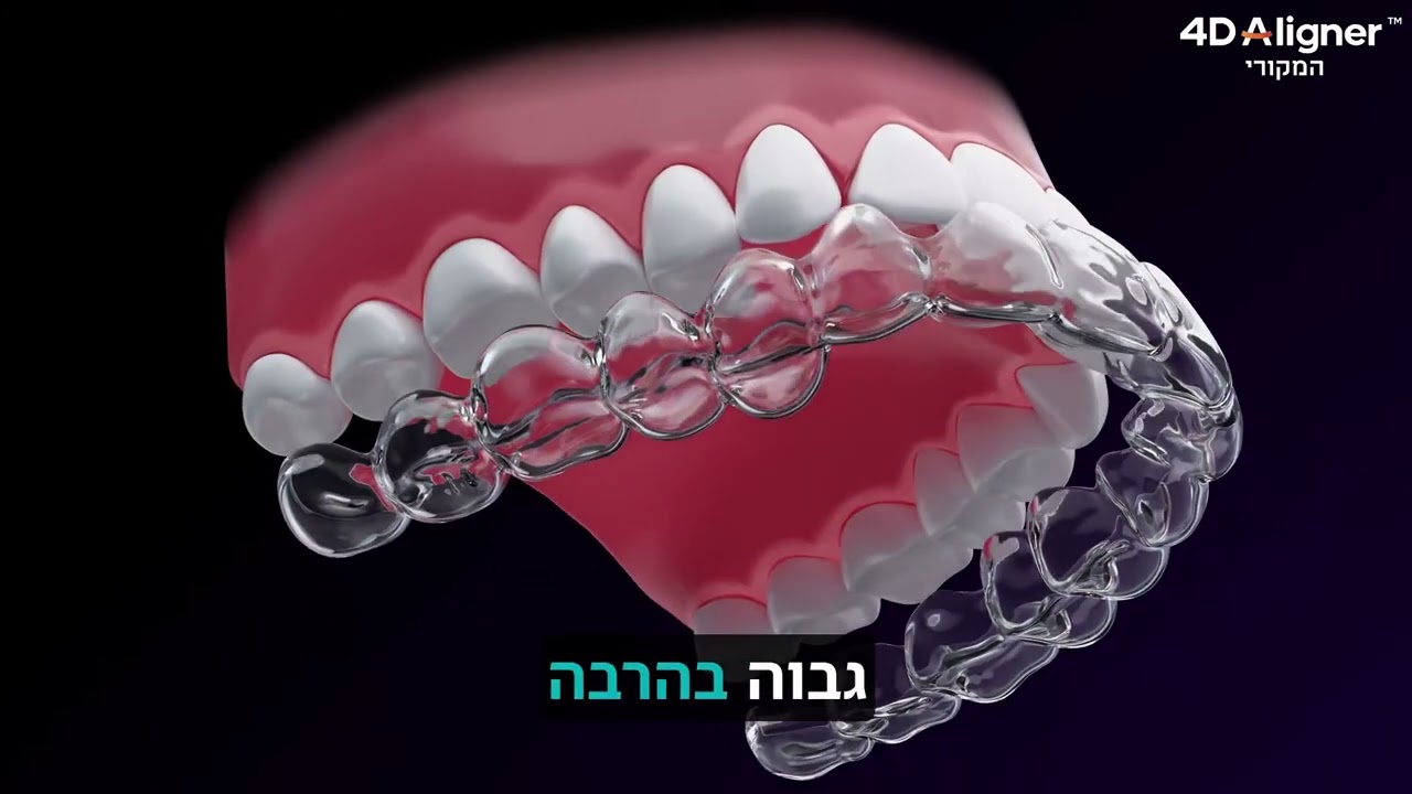 תצוגה מקדימה — סרטון 4D Aligner בעברית